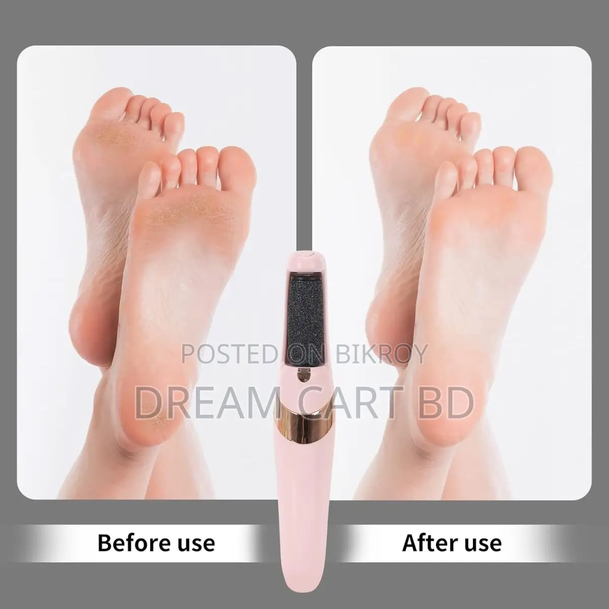 Rechargeable Electric Foot Callus Remover Pedicure Tool