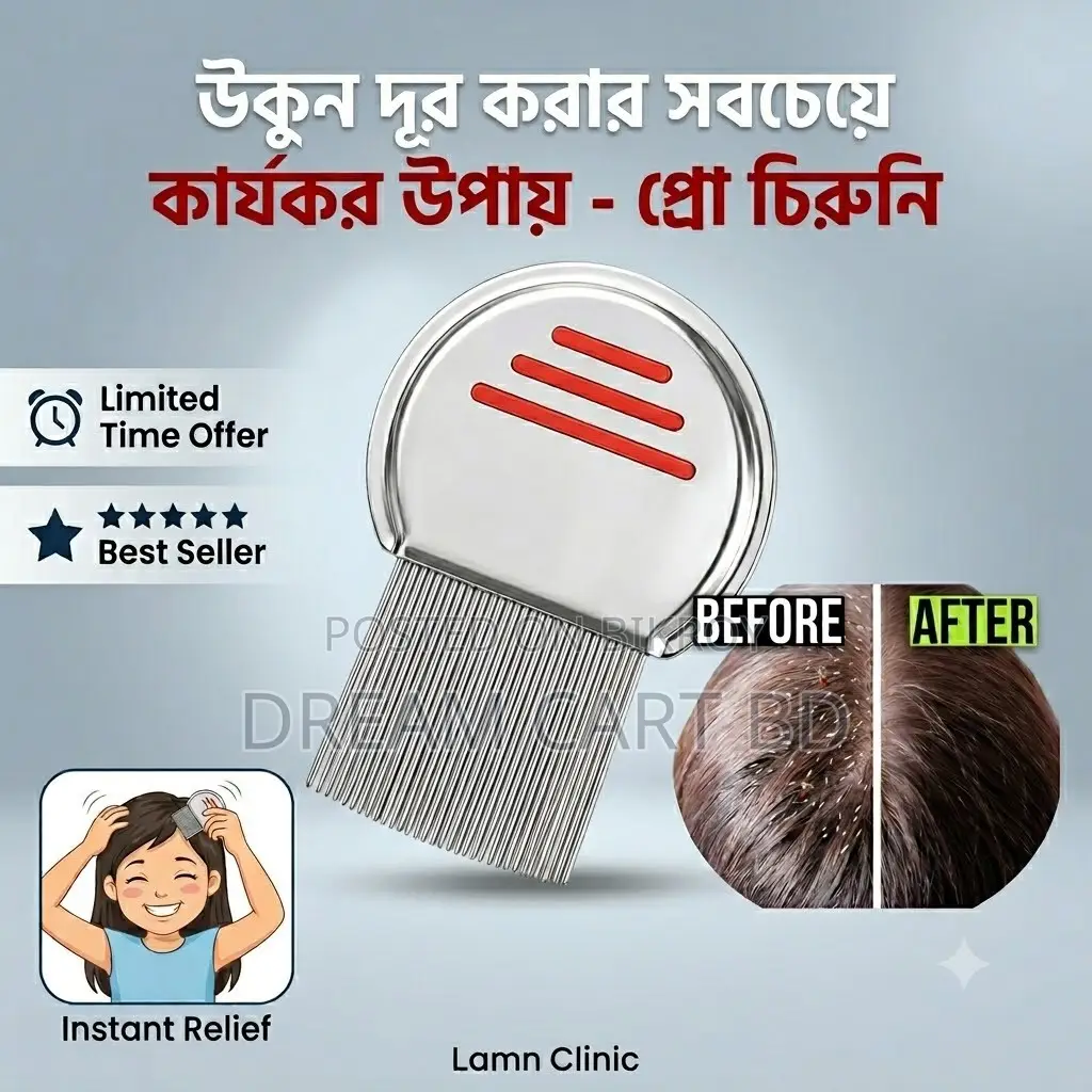 Stainless Steel Fine Tooth Head Lice & Nit Removal Comb