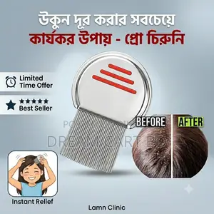 Stainless Steel Fine Tooth Head Lice & Nit Removal Comb