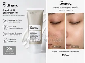(100ml) The Ordinary Azelaic Acid Suspension 10% Brightening Formula