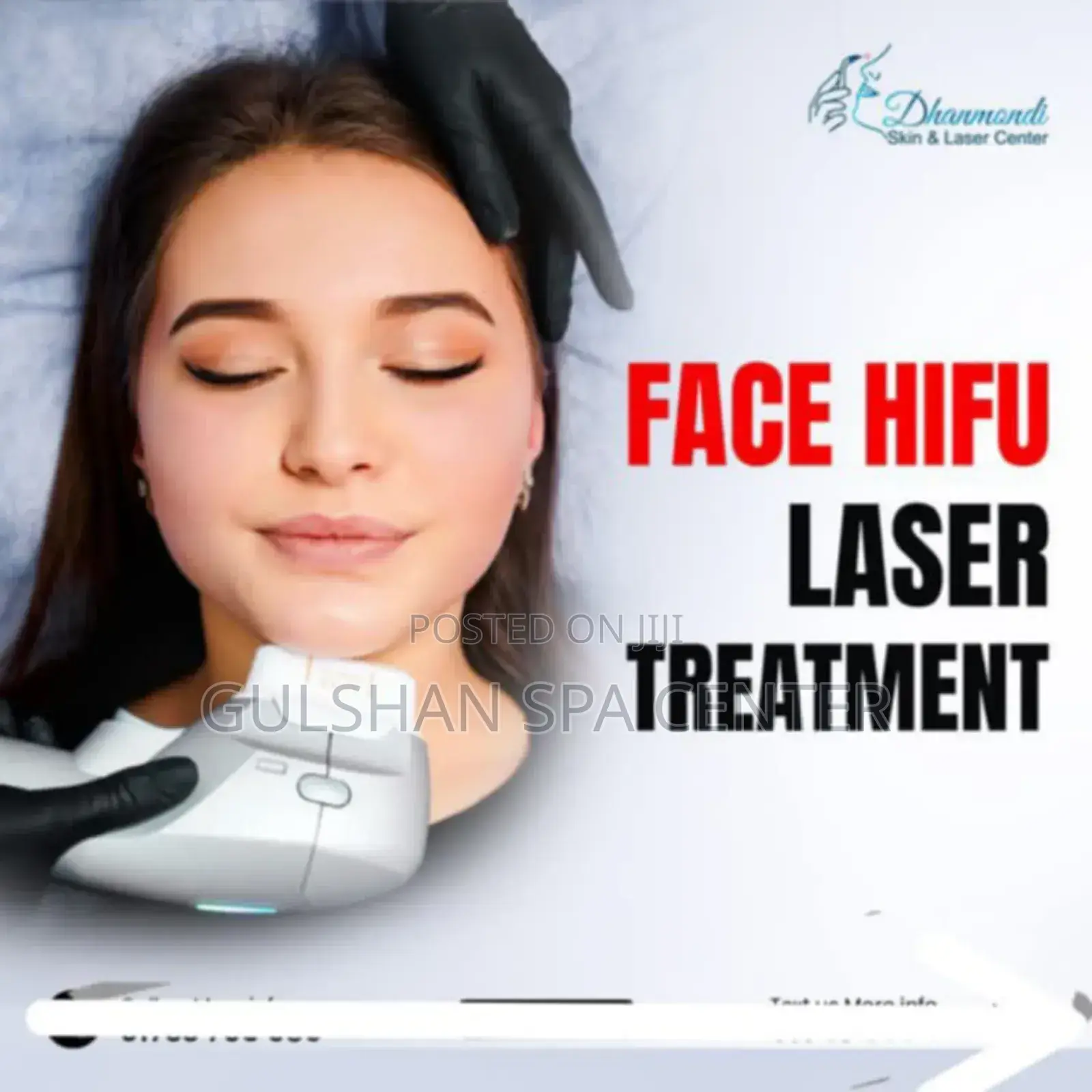 V Shape, Face Lifting, Face Fat