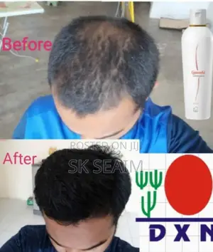 Dxn Ganozhi Shampoo – Herbal Hair Care