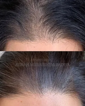 Lafz Onion Seed Essential Oil for Hair