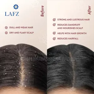 Lafz Onion Seed Essential Oil for Hair