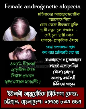Alopecia টাক রোগে চুল গজাবে স্থায়ী ভাবে-ইউনানী আয়ুর্বেদিক