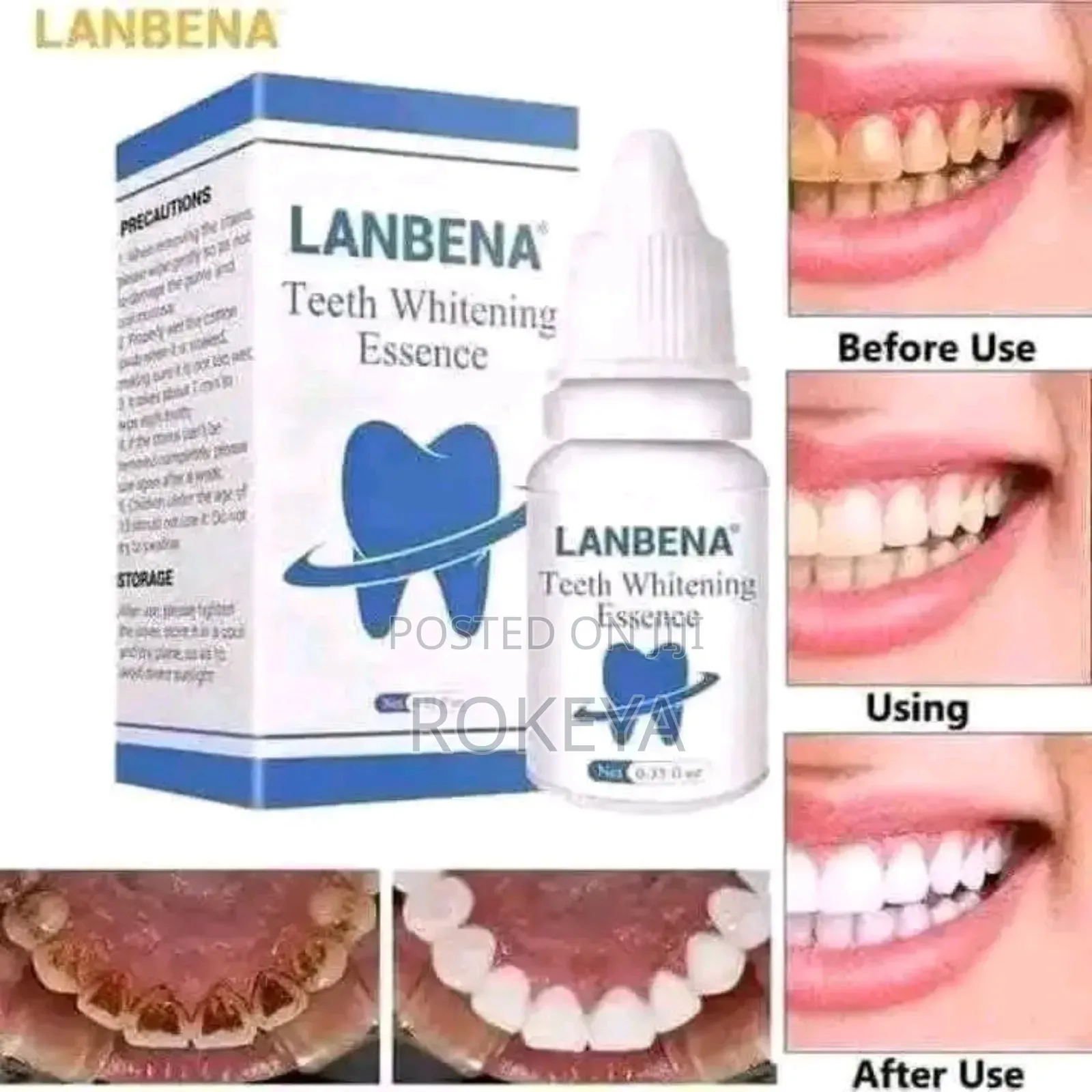 Lanbeena Teeth Cream
