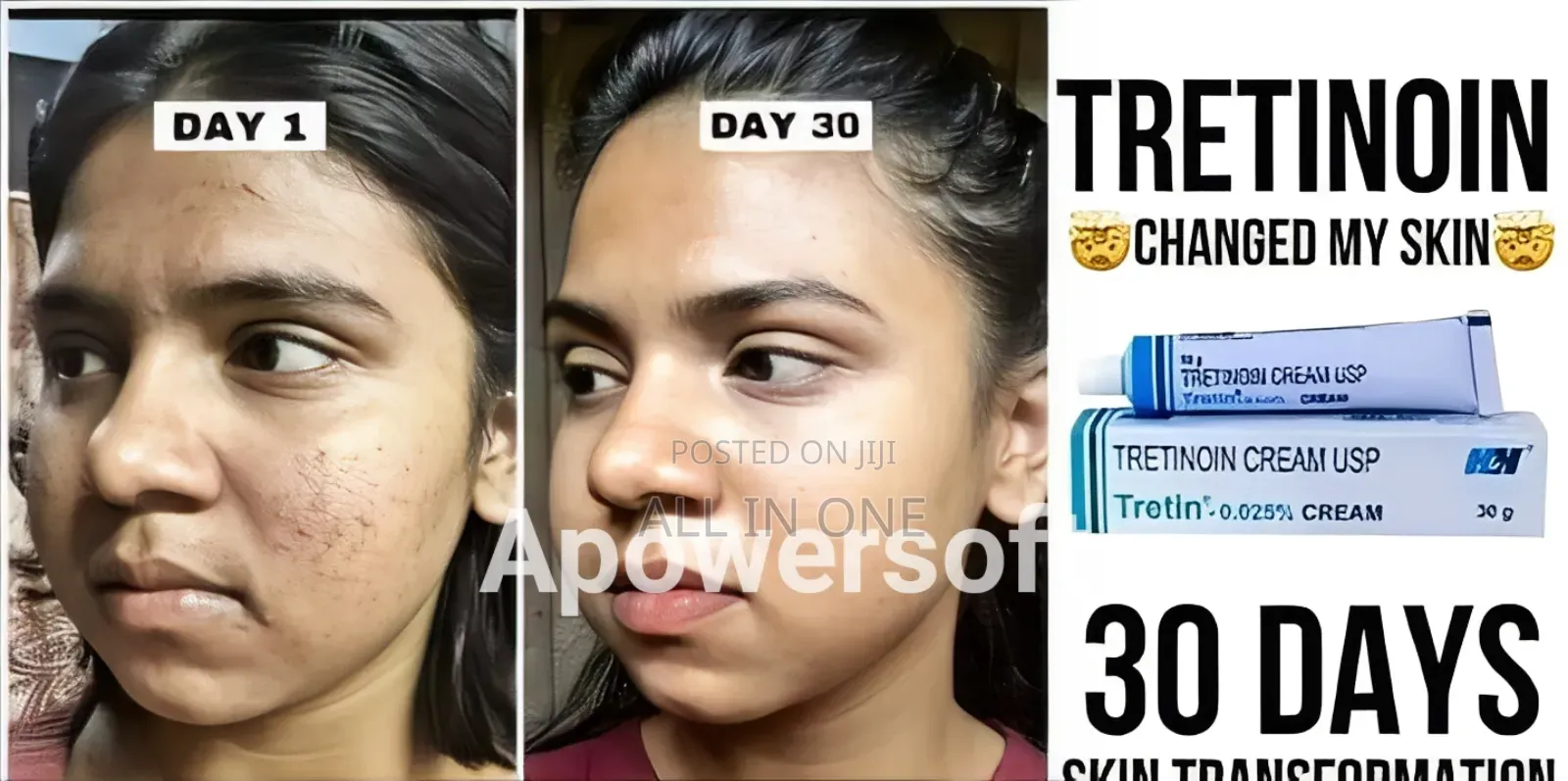 Tretinoin Tretin 0.025% Cream Usp