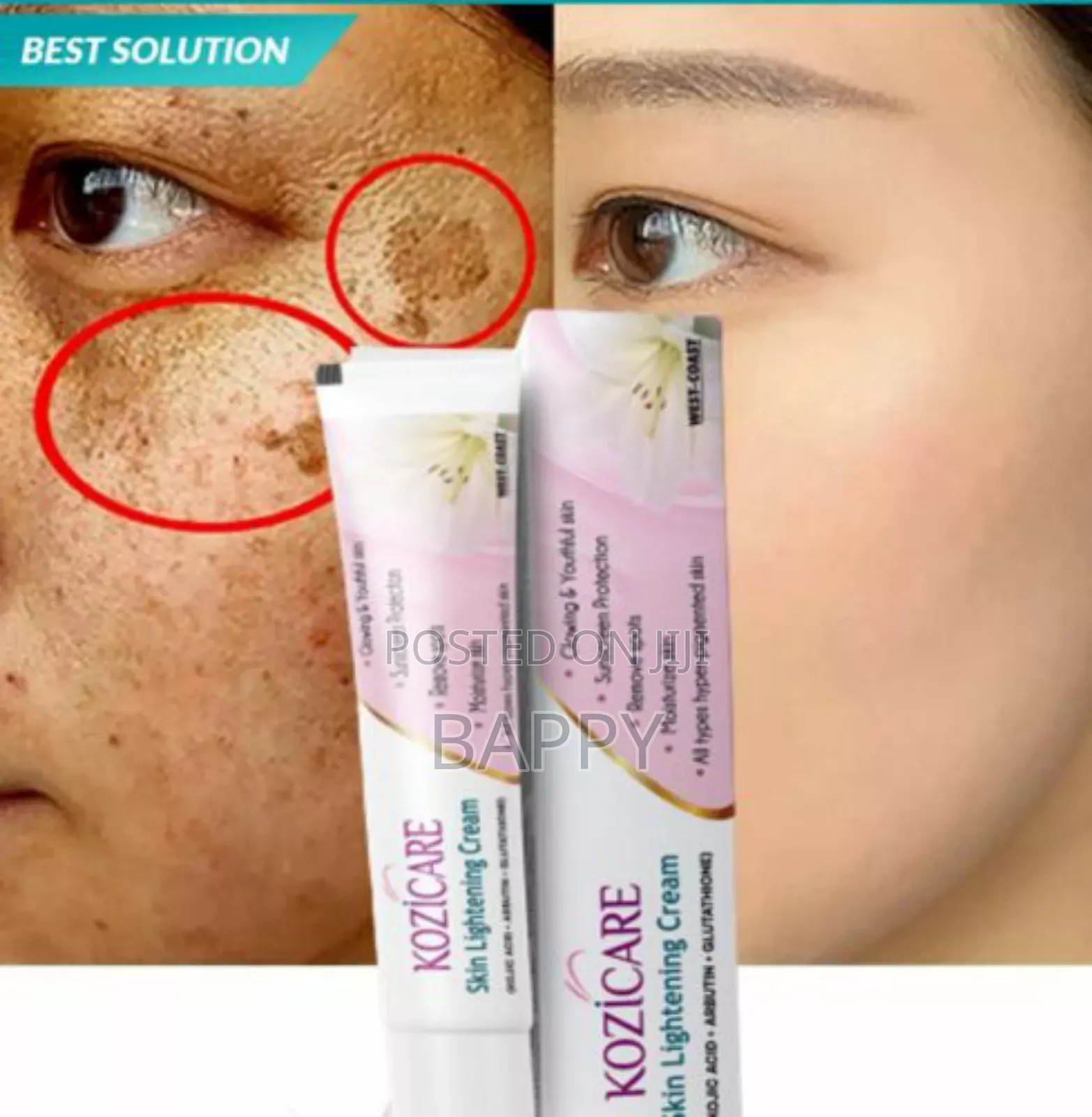 Kozicare Skin Lightening Cream