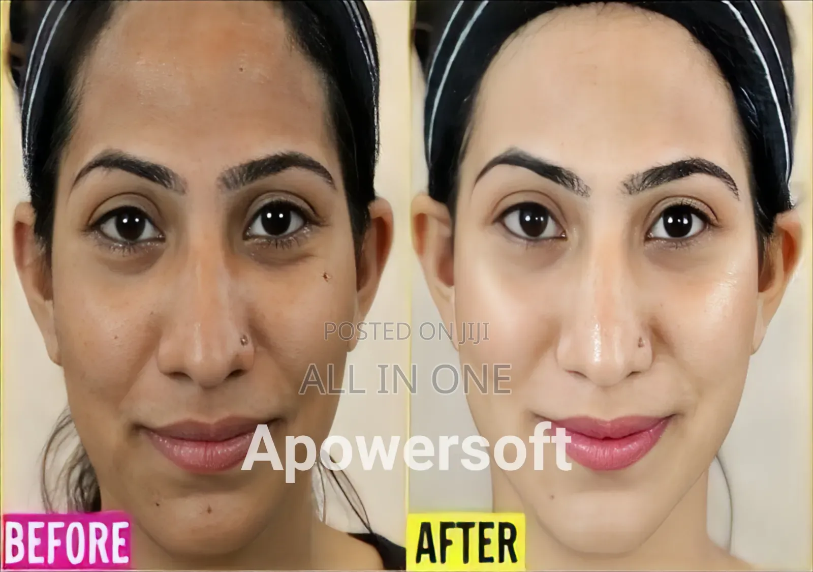 Anti Freckle Red Japanese