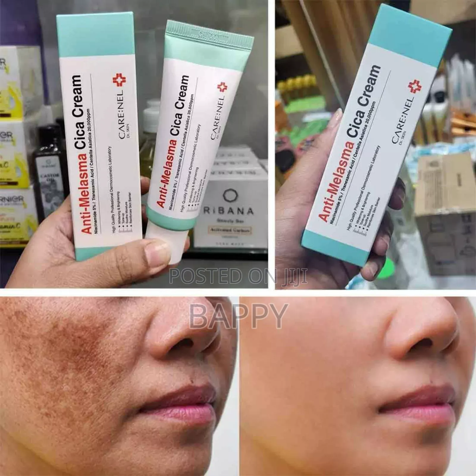 Anti-Melasma Cica Cream