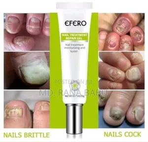 Photo - Efro Nail Repair Essence Gel Fungal Nail