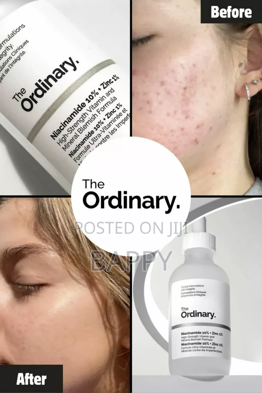 The Ordinary Niacinamide 10% + Zinc 1%