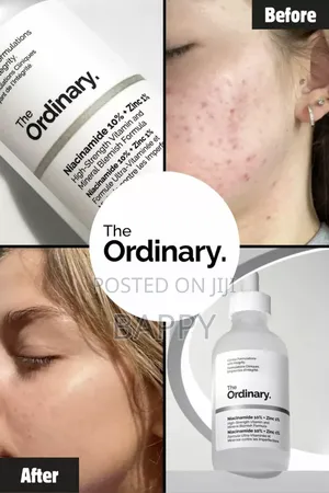 The Ordinary Niacinamide 10% + Zinc 1%