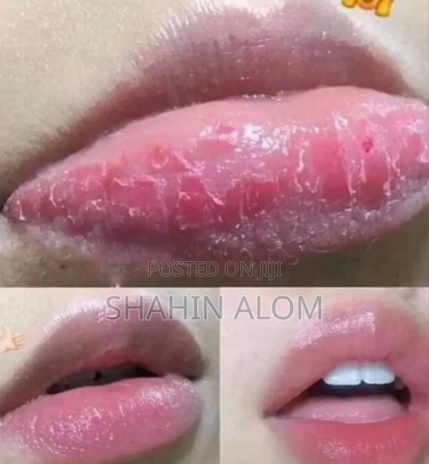 Lip Balm in Pink Jar