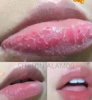 পিঙ্ক জারে লিপ বাম