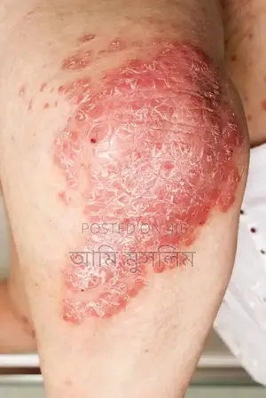 Photo - Medicine for এলার্জি