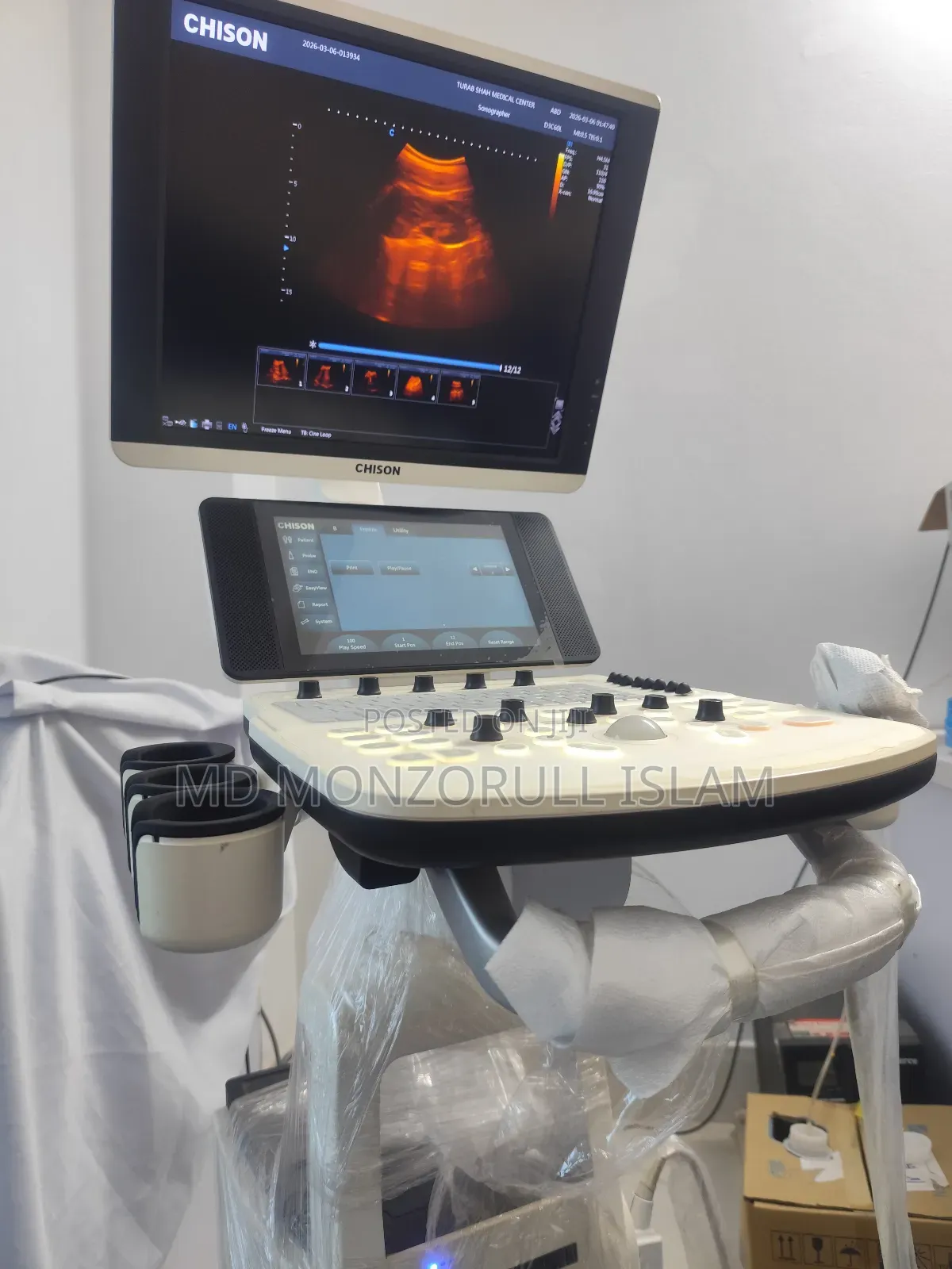 Ultrasonogram Machine