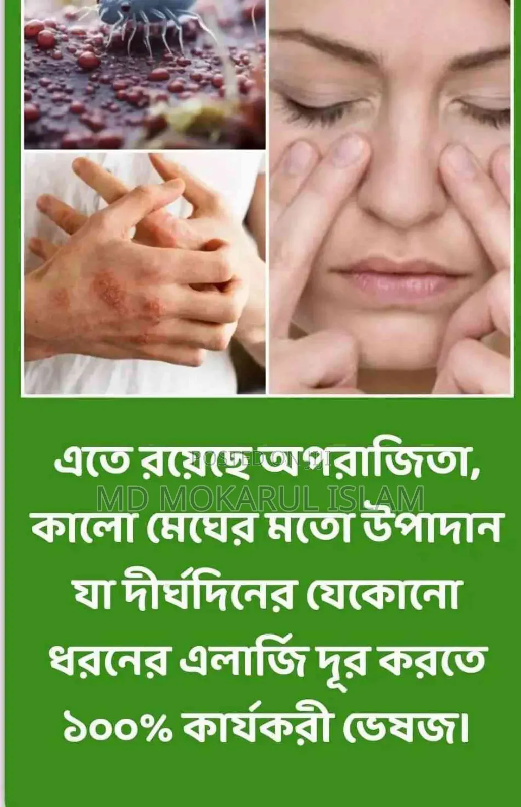 Allergy Binash (Allergy Relief)