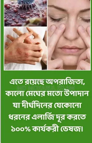 Allergy Binash (Allergy Relief)