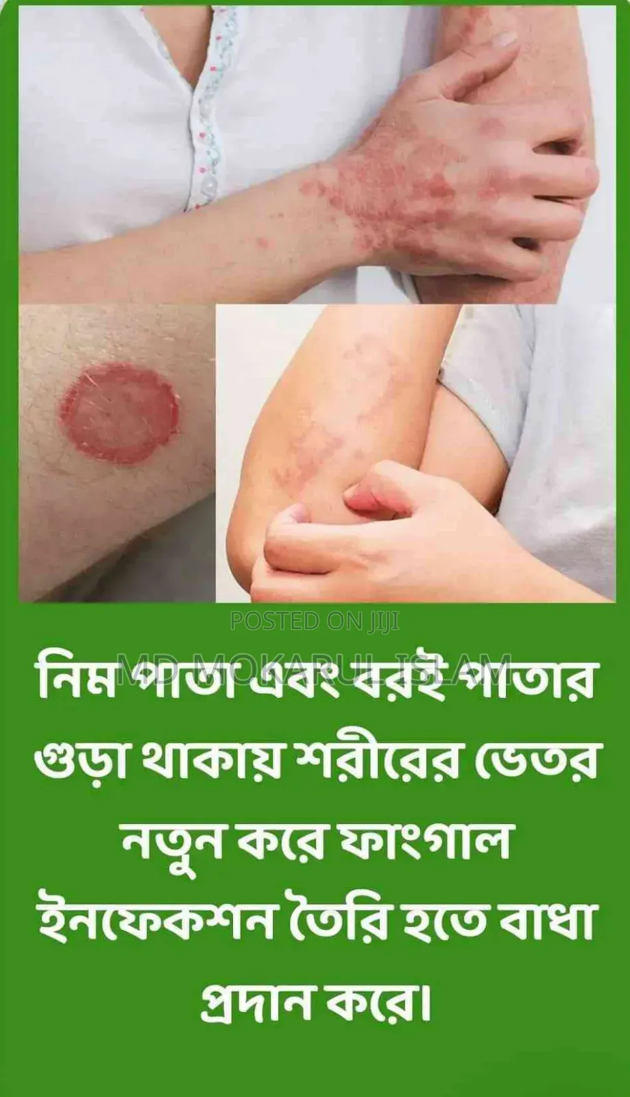 Allergy Binash (Allergy Relief)