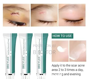 Breylee Acne Scar Removal Cream