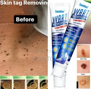 Wart Remover Ointment Best Product