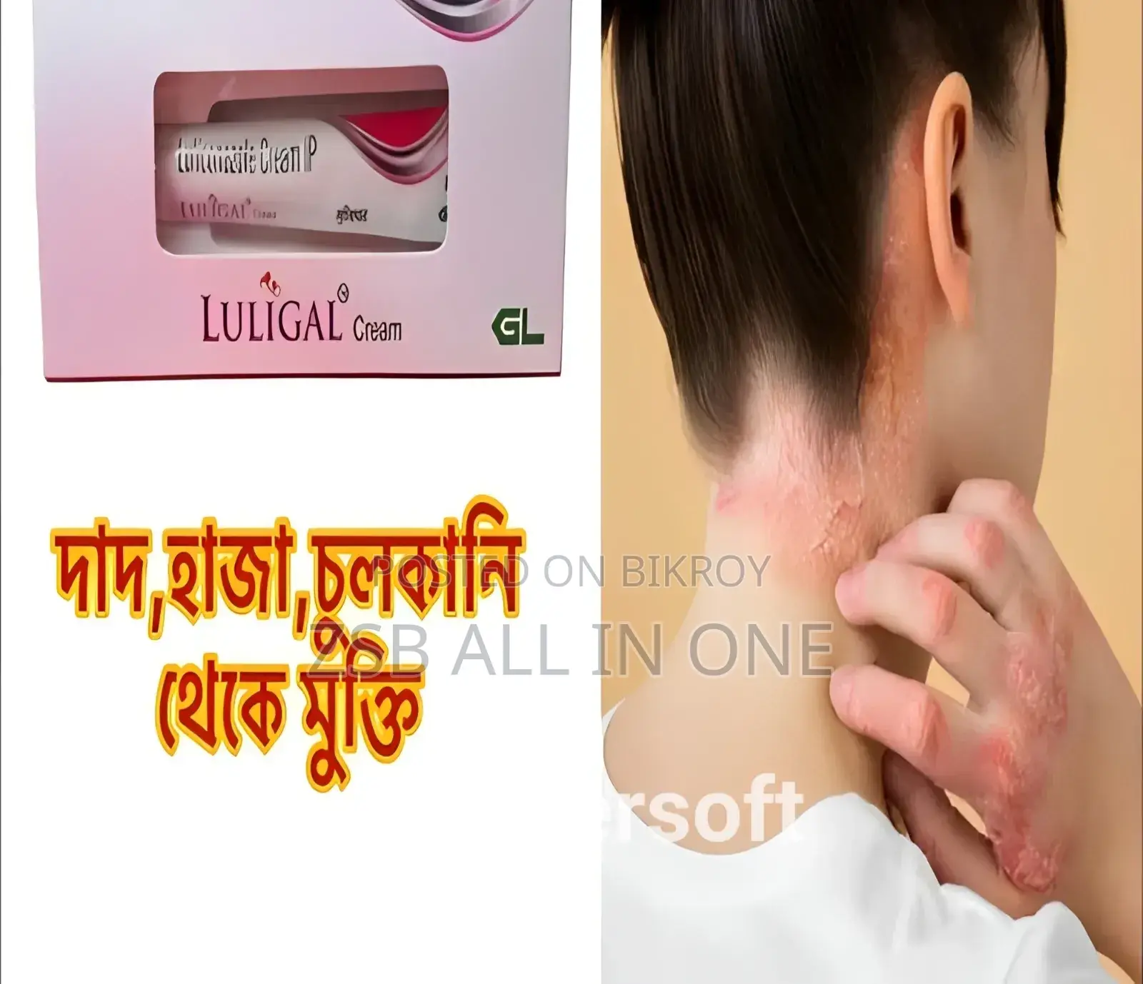 লুলিকোনাজোল ক্রিম