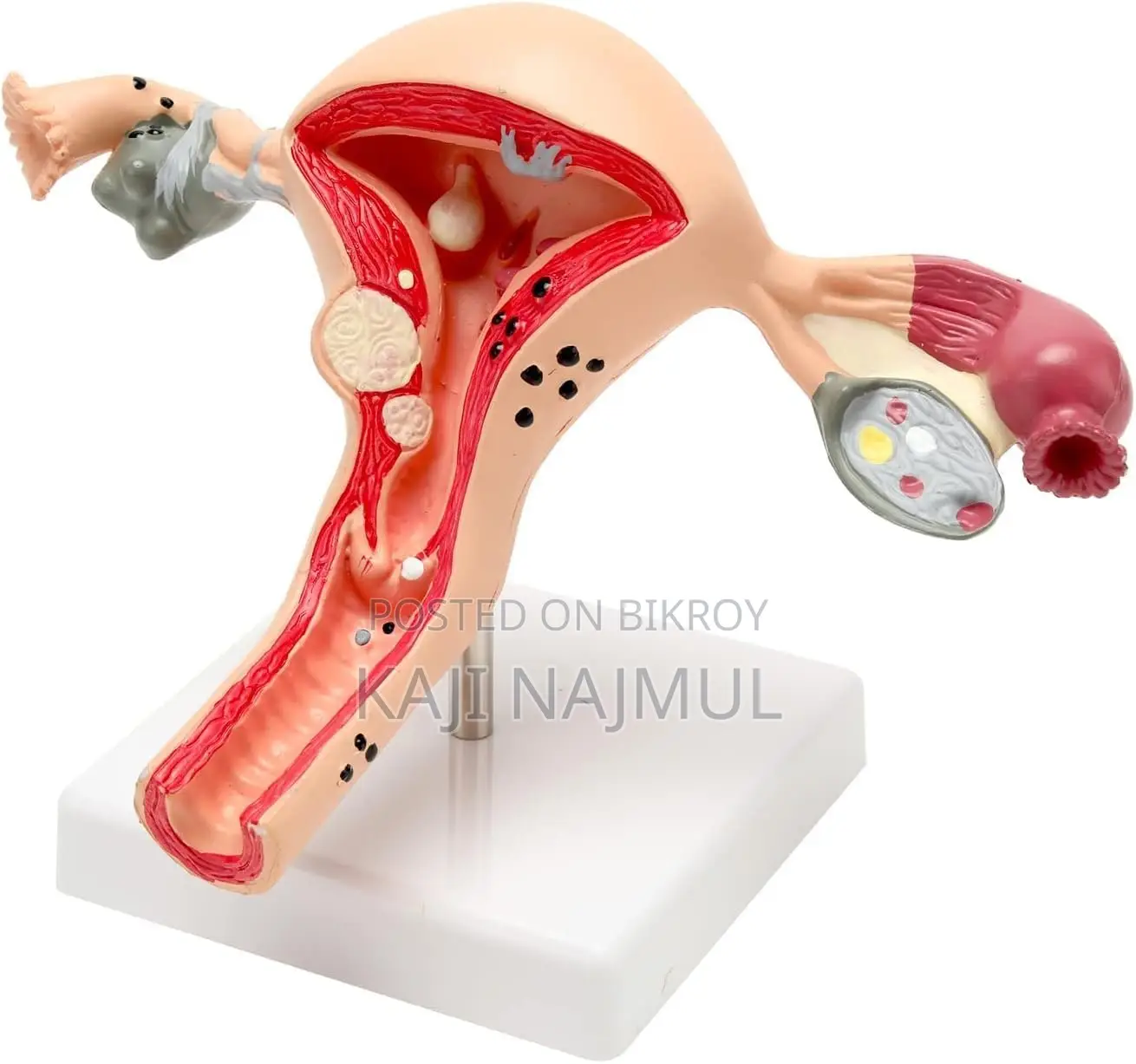 Anatomy of Uterus Model