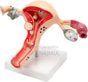 Anatomy of Uterus Model