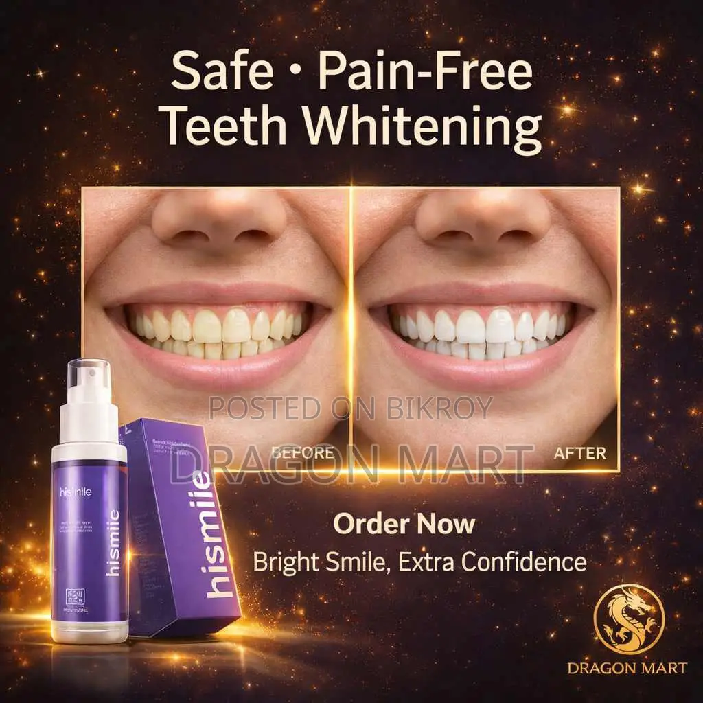 Hismile V34 Color Corrector for a Beautiful and Confident Smile