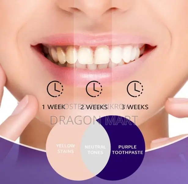 Hismile V34 Color Corrector for a Beautiful and Confident Smile