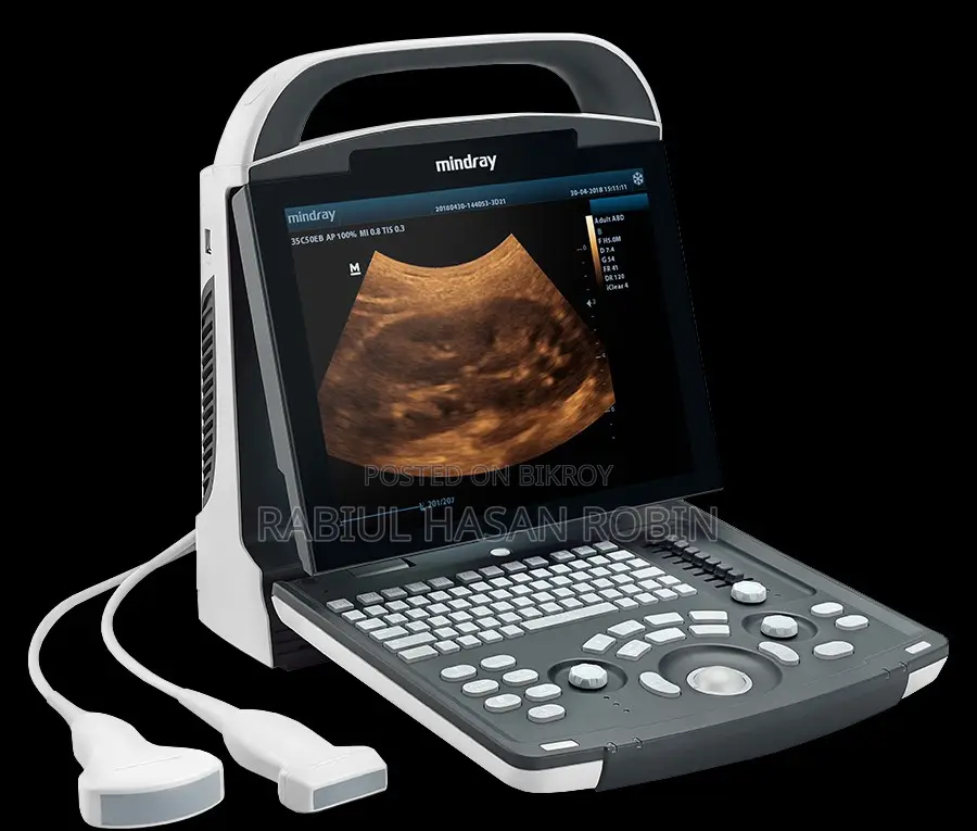 Portable Ultrasound Machine