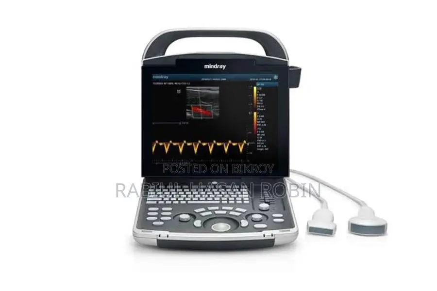 Portable Ultrasound Machine