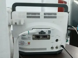 Sonoscape E1 Pro Ultrasound Machine