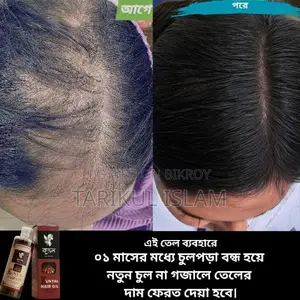 চুল পড়া নিয়ে চিন্তিত? সমাধান এখন আপনার হাতেই!