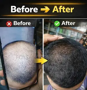 Hair Spray