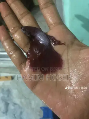 Batta Fish