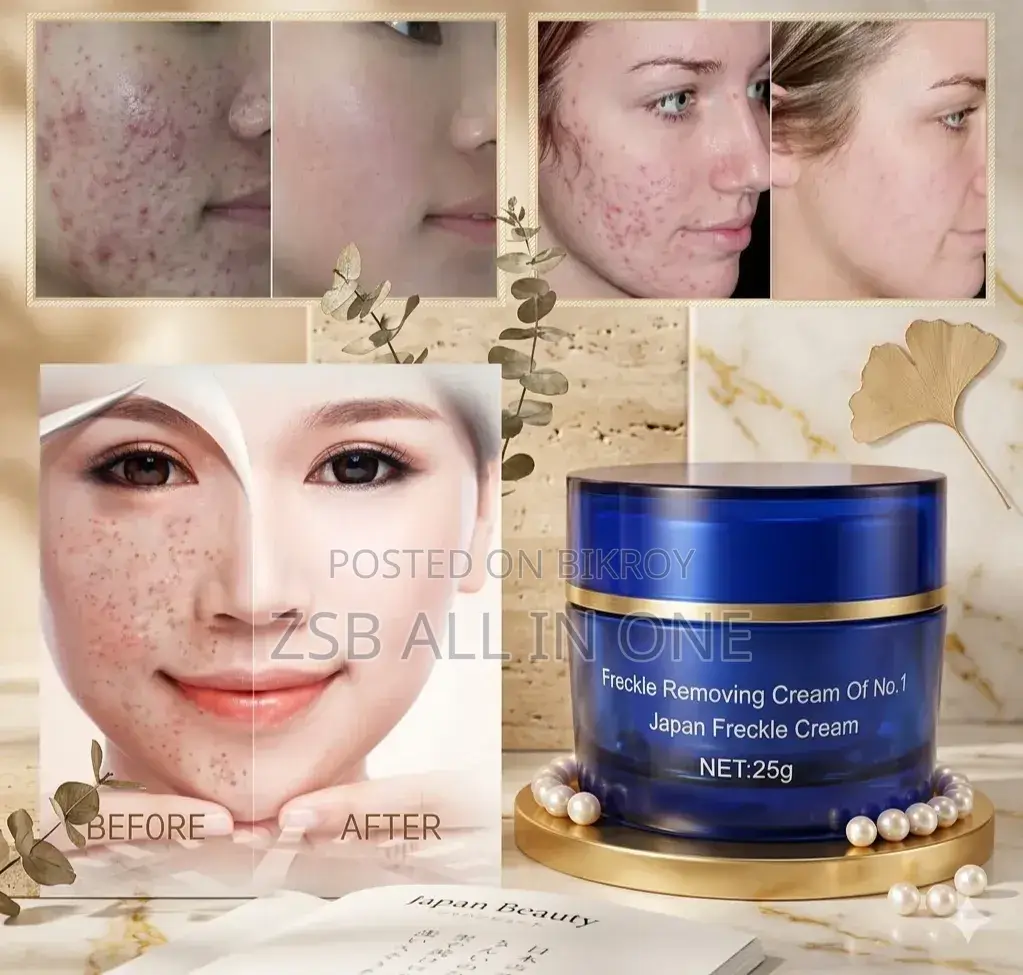 Anti Freckle Whitening Cream Blue New Update