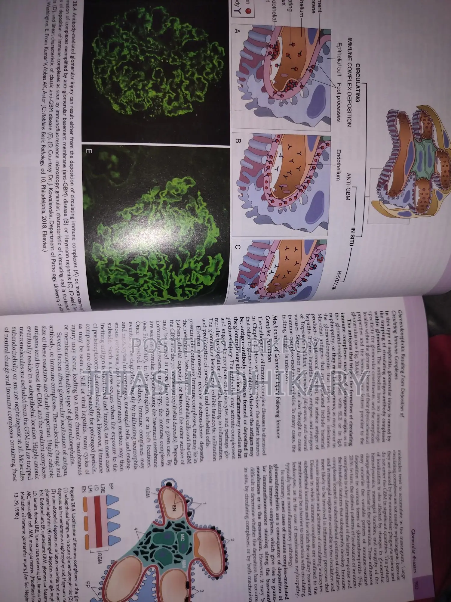 Robbins & Cotran Pathological Basis Of Disease, 10th Edition