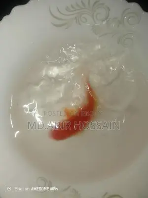 Best Fish for Your Aquarium Here