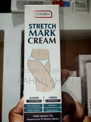 Stretch Mark