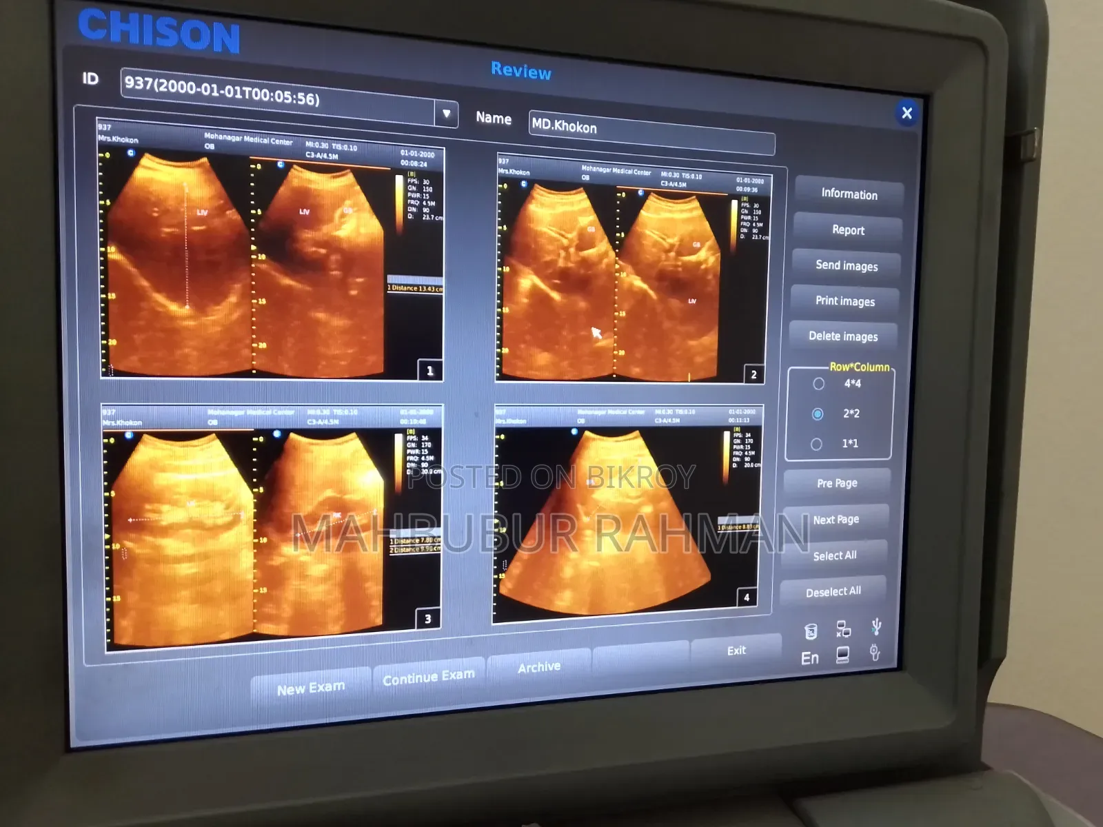 Ultrasound Machine