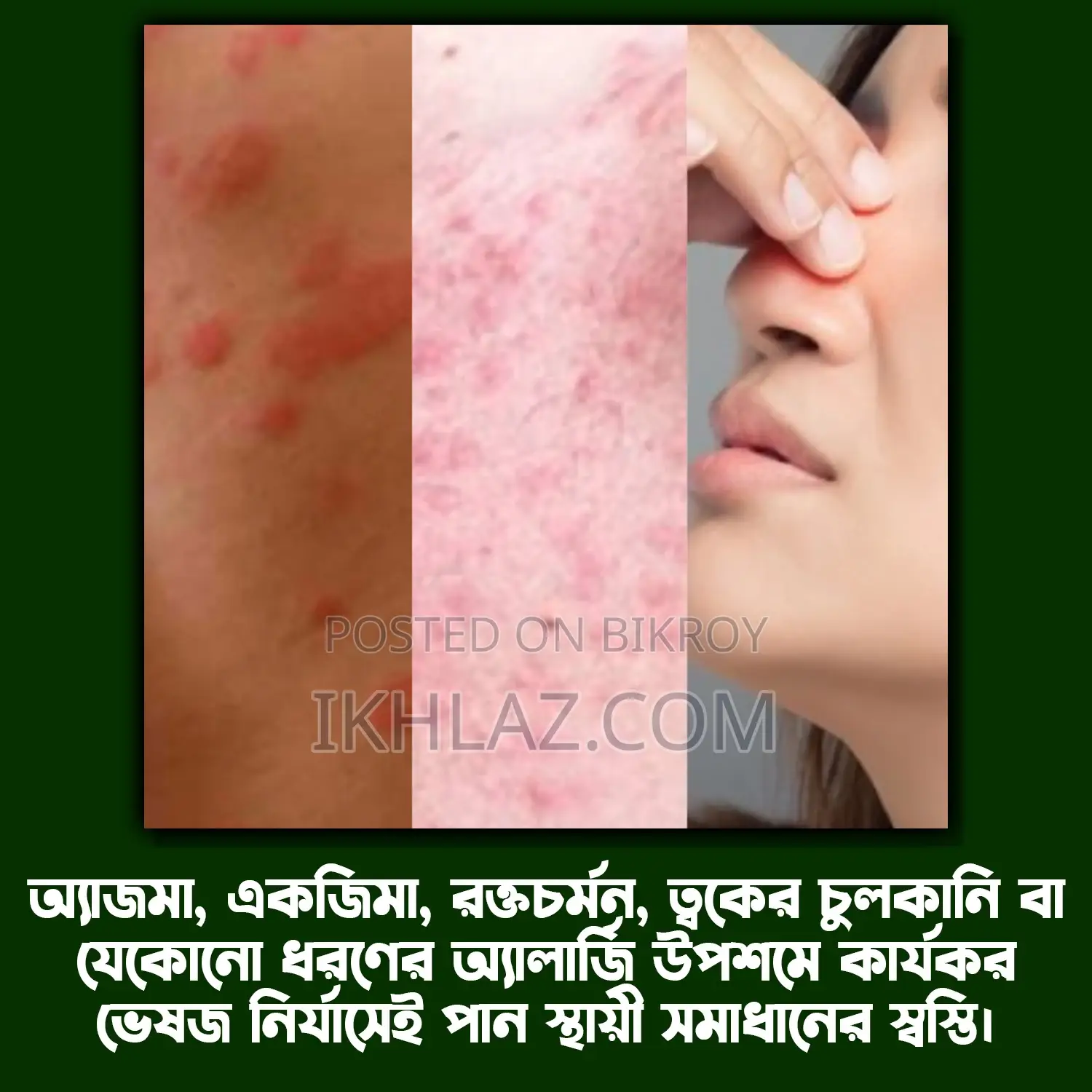 Ikhlaz Allergy Shifa - 100% Natural and Permanent Solution.