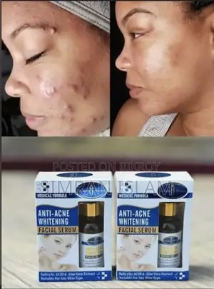 Aichun Beauty Anti Acne Whitening Serum