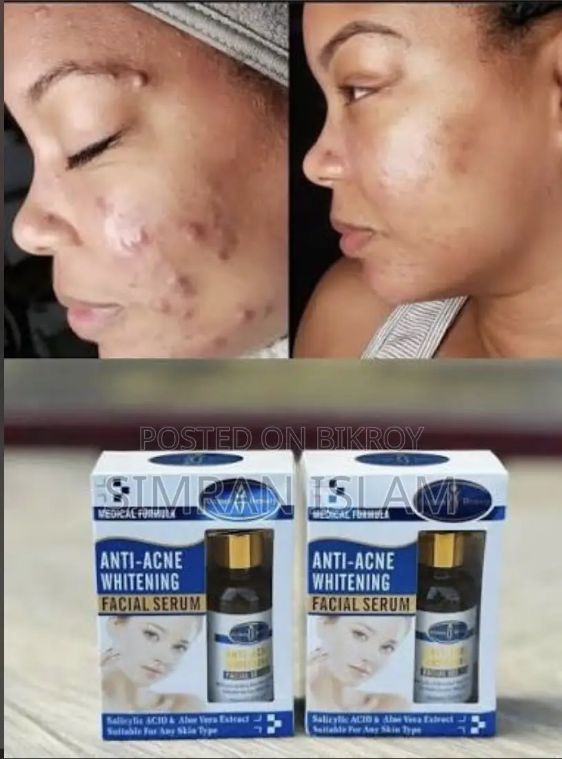 Aichun Beauty Anti Acne Whitening Serum