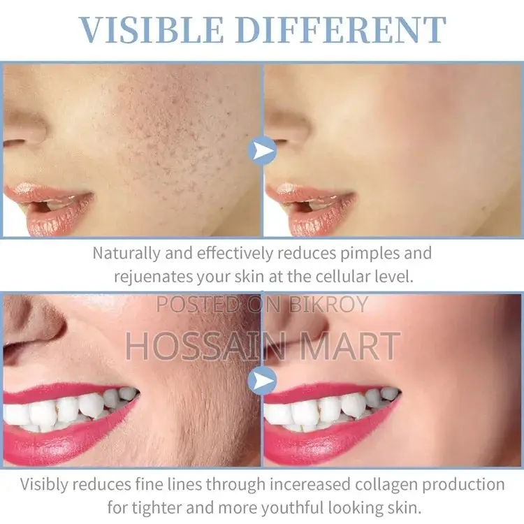 High Frequency Facial At Home