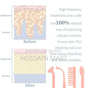 High Frequency Facial At Home
