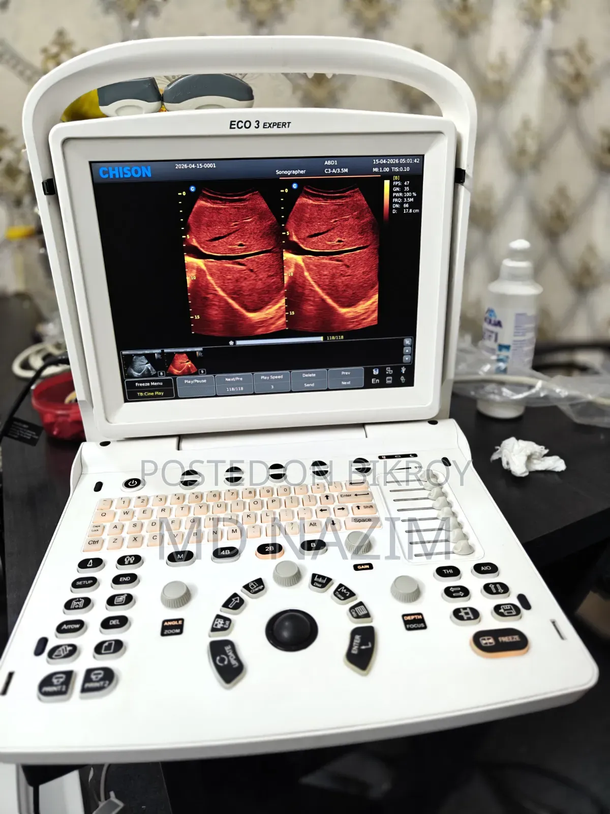 3D Color Doppler Ultrasound Machine with Linear Probe