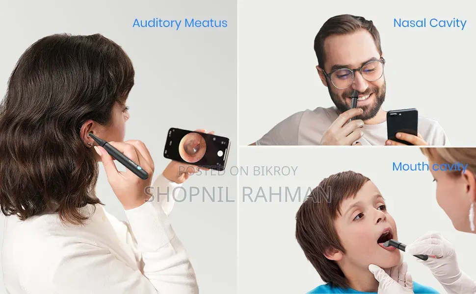 Bbird Xiaomi Ear Cleaning Camera