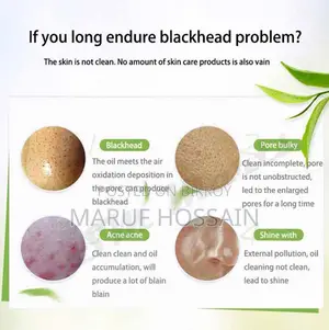 Bioaqua Activated Carbon Charcoal Blackhead Removal